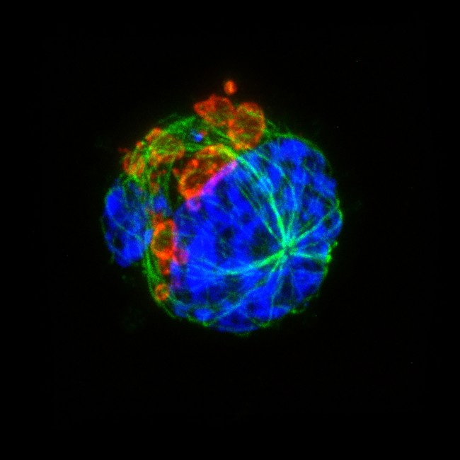 METEORページ The Meteor | NIAMS